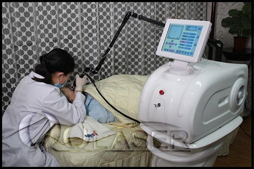 cong-nghe-laser-acne.jpg