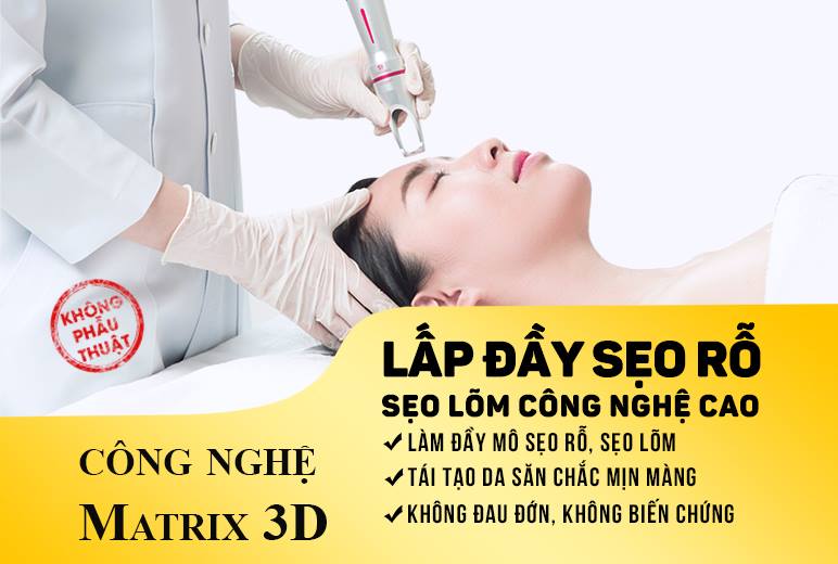 Cong-nghe-tri-seo-ro-hieu-qua.jpg