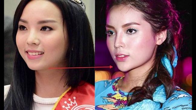 cung-dinh-nghi-van-tham-my-huyen-my-khong-khon-kho-vi-scandal-nhu-ky-duyen_71447497.jpg
