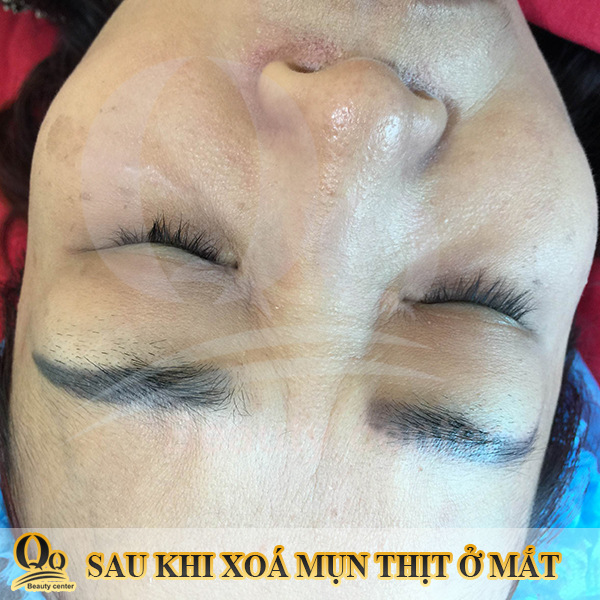 dot-mun-thit-bao-nhieu-tien.JPG