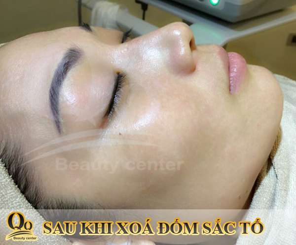 Hoa-khoi-pham-yen-di-spa.jpg