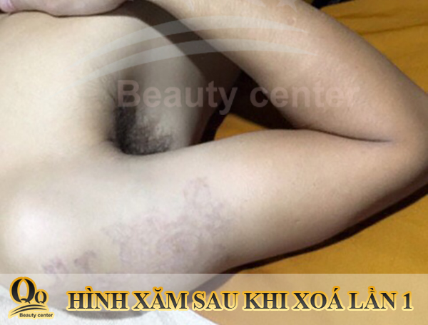 kem-che-hinh-xam-tam-thoi.JPG