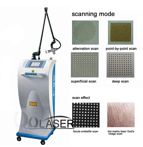 Laser_acupules-tri-seo-ro.jpg