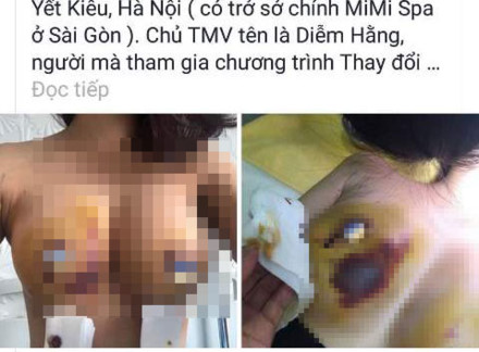 nang nguc hong 2_TKFI_KGJA.jpg