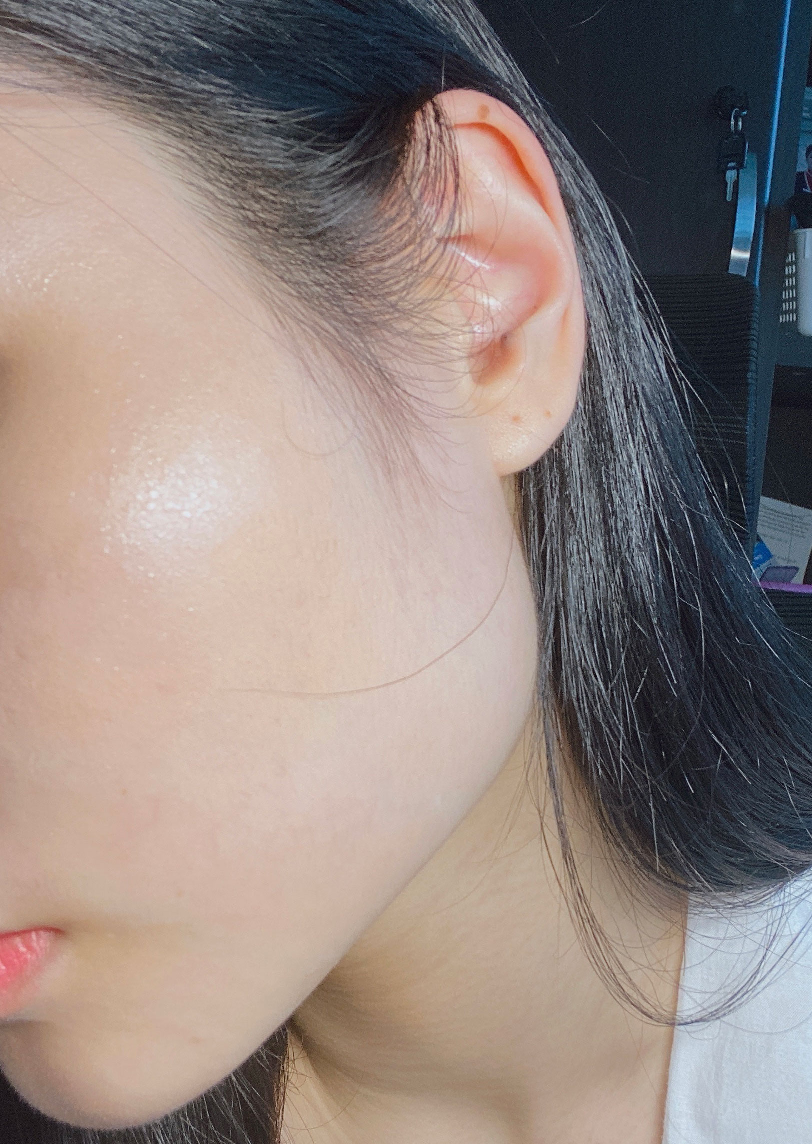 review-boc-phot-tri-mun-tai-tham-my-vien-thanh-quynh.jpg