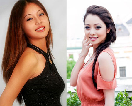 sao-viet-phau-thuat-tham-my-5.jpg
