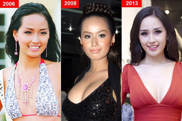 sao-viet-phau-thuat-tham-my-6.jpg