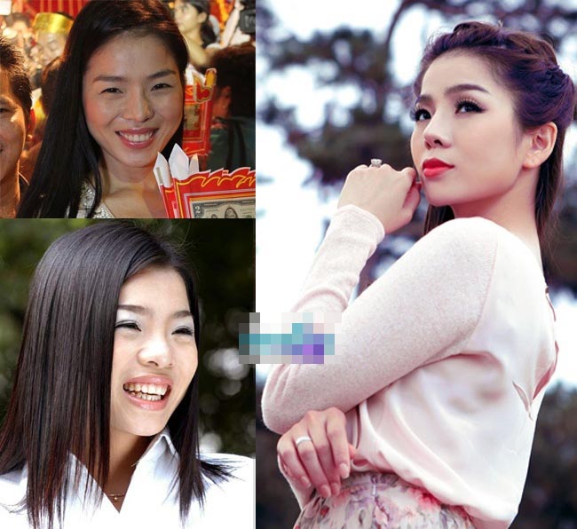 Sao-viet-phau-thuat-tham-my-7.jpg