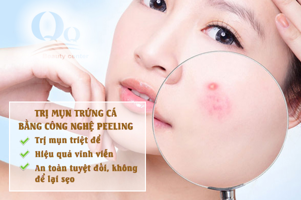 spa-tri-mun-uy-tin-o-ha-noi.jpg
