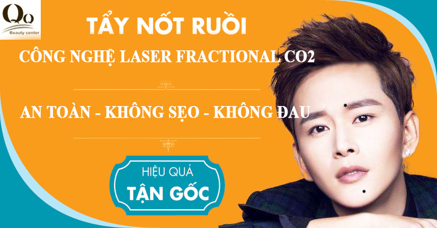 tay-not-ruoi-bang-tia-laser-bao-lau-thi-lanh.jpg