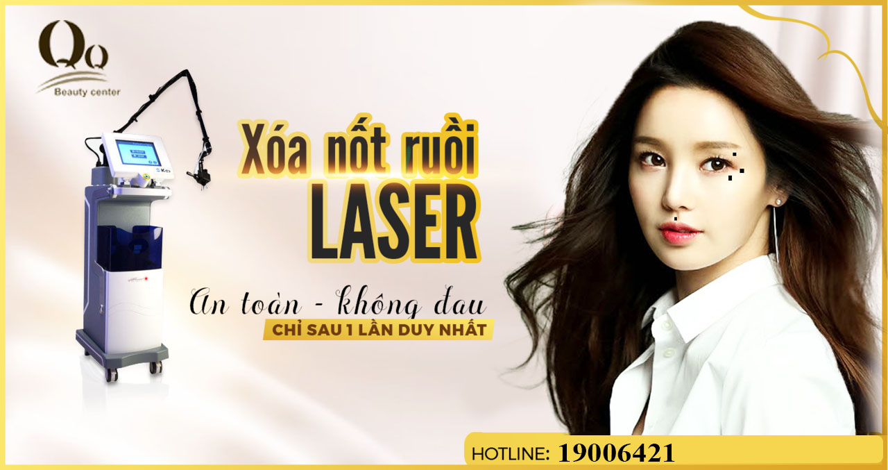 tay-not-ruoi-bang-tia-laser-gia-bao-nhieu.jpg