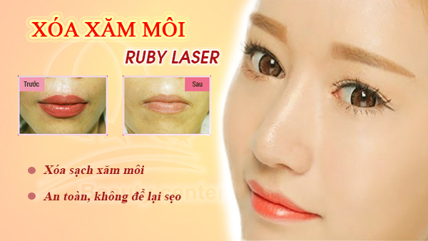 Tham-my-vien-xoa-xam-chan-may-o-Ha-Noi.jpg