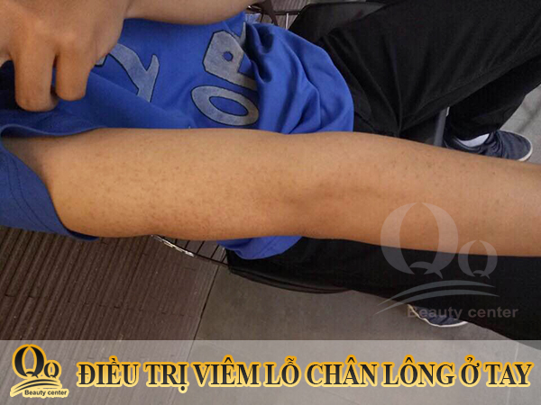 thuo-boi-day-sung-nang-long.JPG