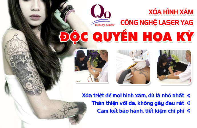 Xoá hình xăm ở bệnh viện da liễu  Hà Nội hay thẩm mỹ viện ?